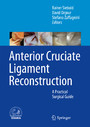 Anterior Cruciate Ligament Reconstruction - A Practical Surgical Guide